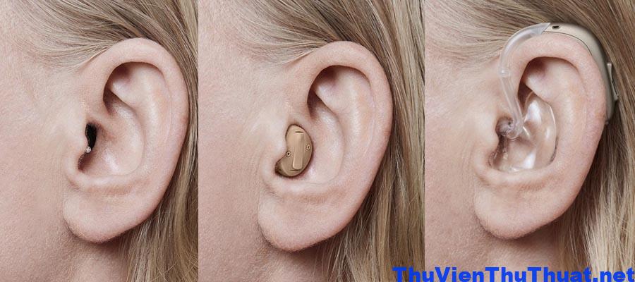 Mua máy trợ thính ở đâu? Máy trợ thính cho người già giá bao nhiêu